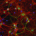 Vaccin tegen Altzheimer stap dichterbij