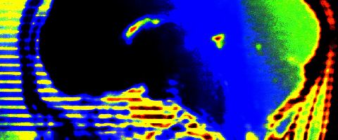 Canadees onderzoek toont aan dat tweetaligheid de kans om te gaan dementeren vertraagt